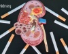 Fumare fa male ai reni? Una prospettiva scientifica